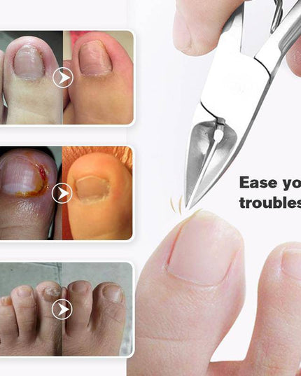 Last Day Promotion（50% OFF ）Medical-grade Nail Clippers - Libiyi